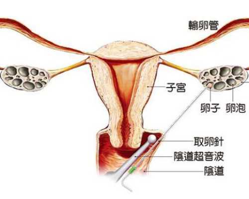 天津试管助孕生子助孕机构多少钱-试管生殖助孕机构