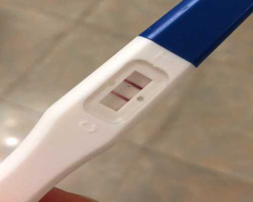 青岛卖卵捐卵,青岛有捐卵代孕医院么？