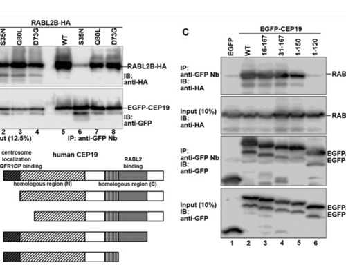 两名菏泽患儿在山大齐鲁医院（青岛）顺利完成人工耳蜗植入术