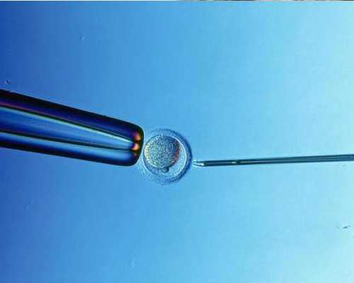 供卵生男孩,北京合法助孕试管中心