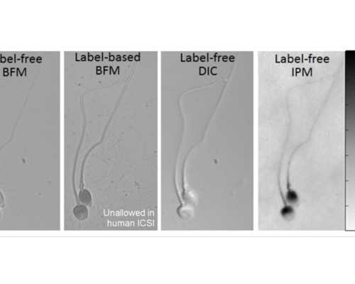 青岛妇女儿童医院供卵试管