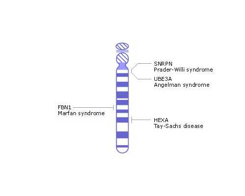 代怀价格贵吗,2023信阳三代试管助孕生子价格公布，2023助孕费用筹算指南